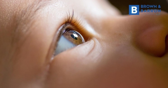 Baby with Horner's syndrome