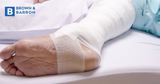 A leg has been treated for a bedsore