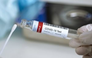 COVID-19 test