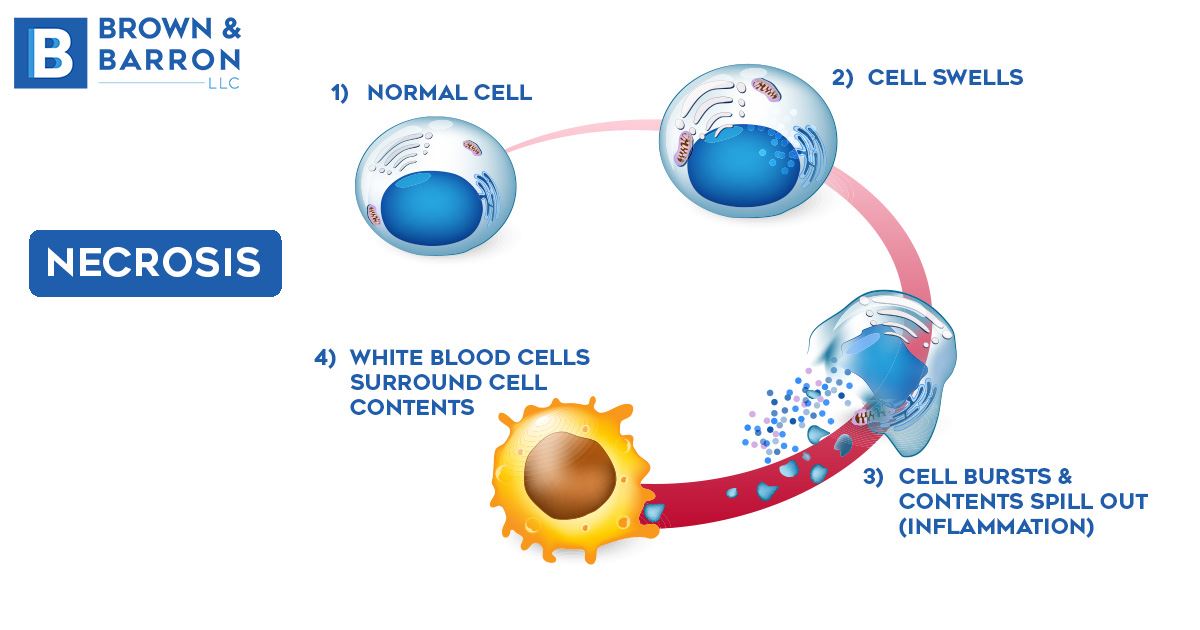 Illustration Depicting the Process of Necrosis